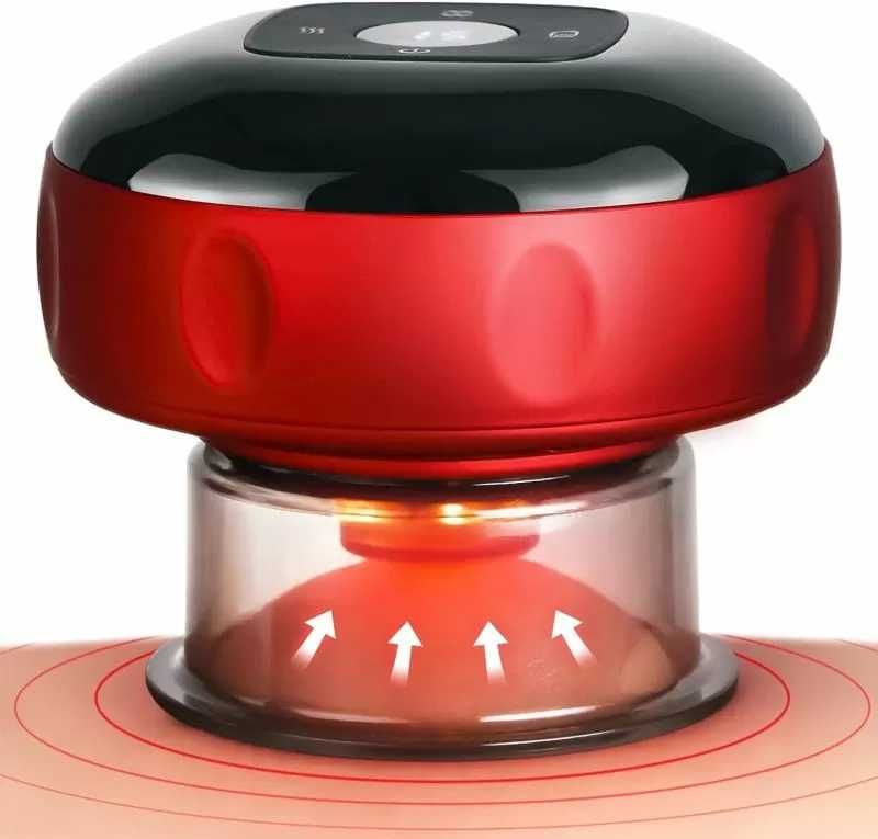 Електрическа вендуза Techniker SC01  DS-A23, 12 нива на интензивност