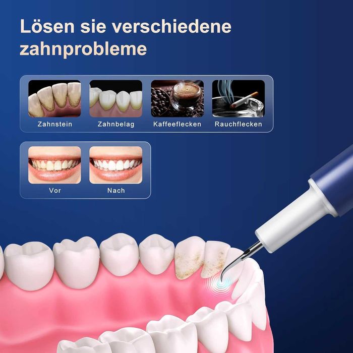 Set Profesional de Curățare a Dinților cu Ultrasunete, 4 Capete/Moduri