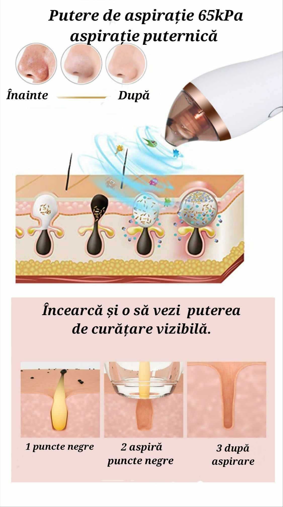 Aparat profesional ingrijire faciala, aspirat puncte negre wifi