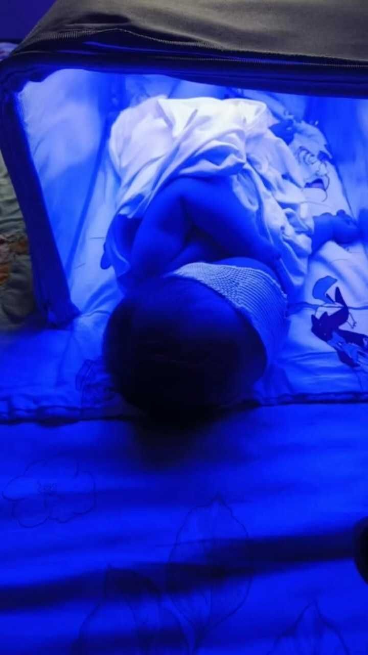 Фотолампа от желтухи у новорожденных.Билитест.Фототерапия