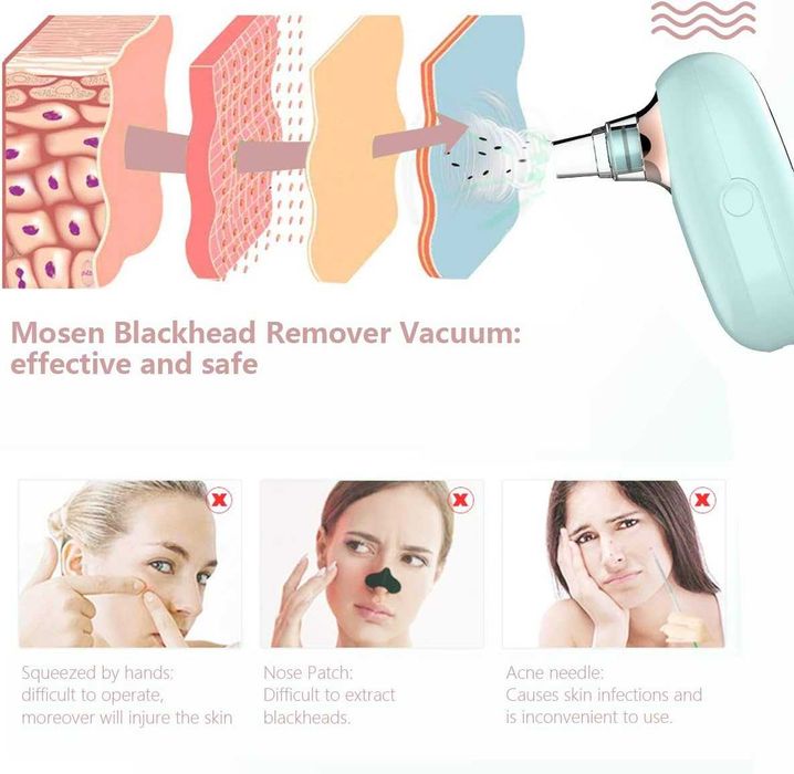 Професионален уред за почистване на порите на лицето Mosen