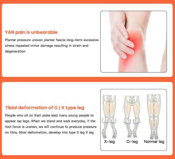 Дюстабан Стелки Плоскостъпие ПадналСвод ПлоскоСтъпало ПлантаренФасциит