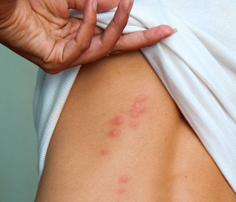 Уничтожение клопов и тараканов