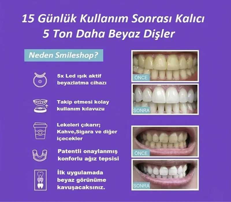 Система для отбеливания зубов гель и капа. tishlarni oqartirish
