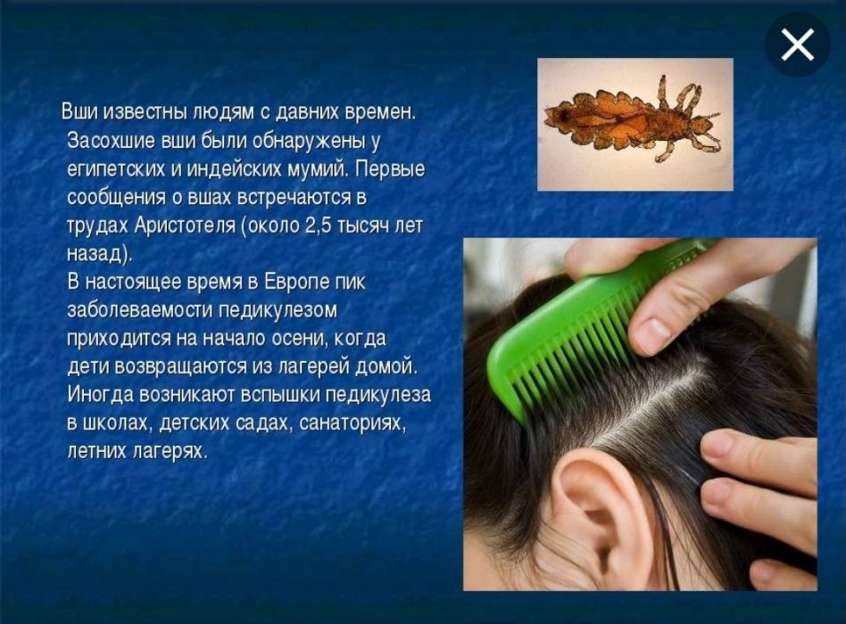Vacuum Eliminate для чистки волос Bit tozalidigan moshina