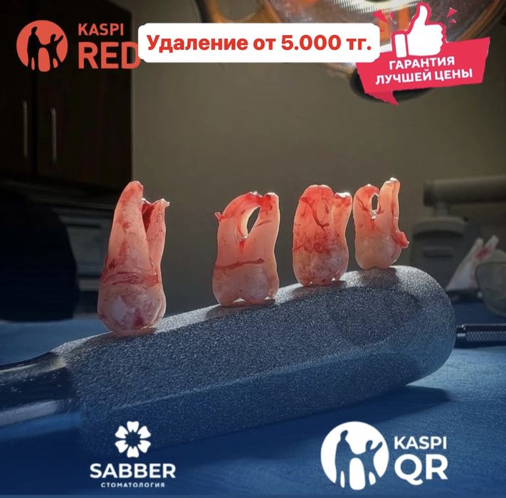 Удаление зубов! от 6999 тг. ! Стоматология 24/7 с гарантией 100%