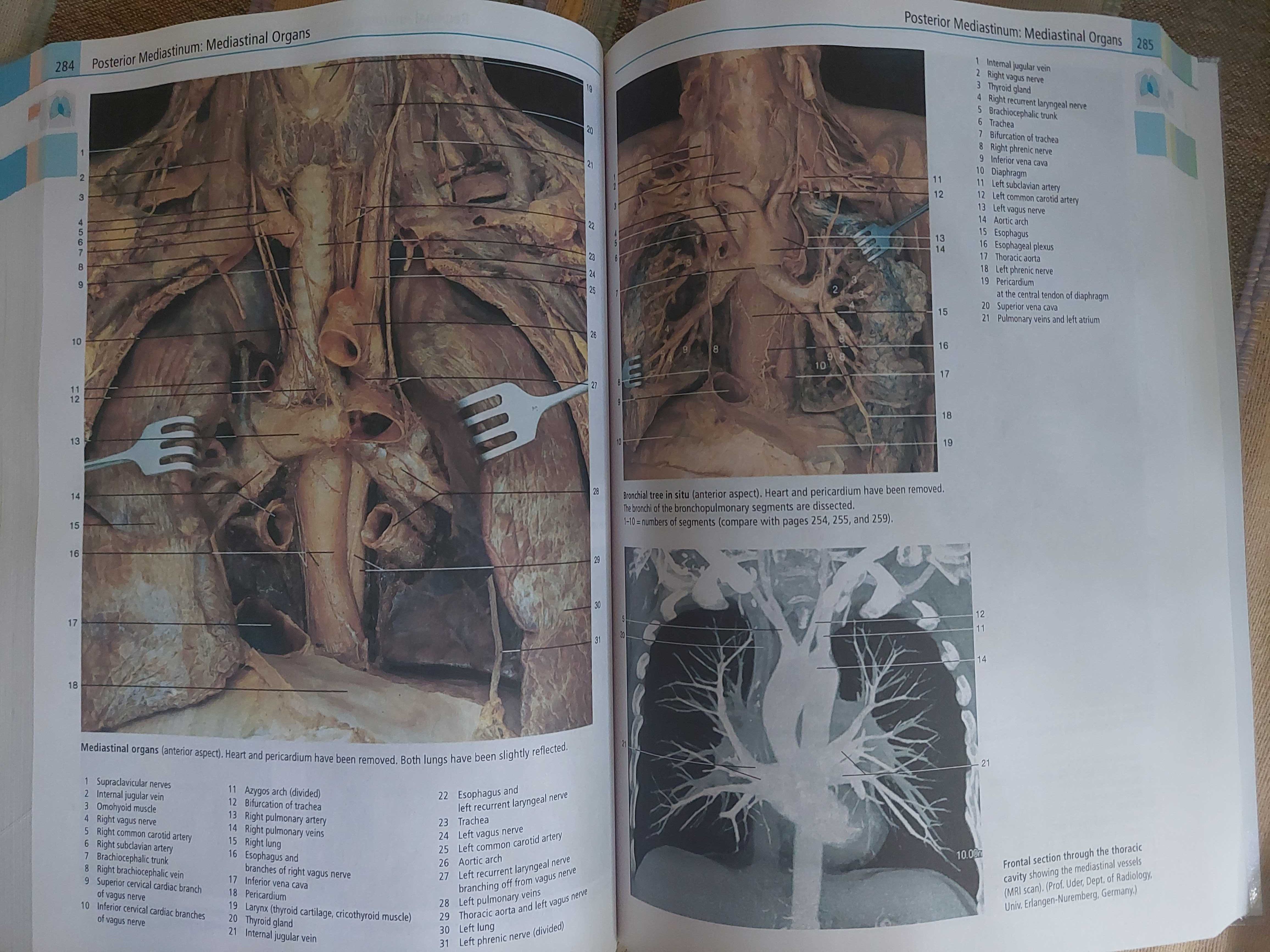 Atlas de Anatomie Umana