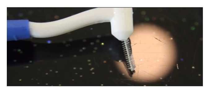 Periute Interdentare L shaped, 0.4 mm Set 5 buc + 0.5 mm - Set 5 buc