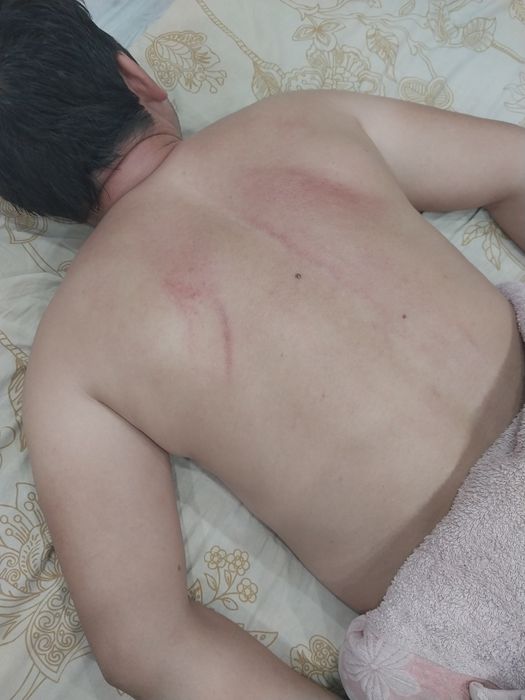 Профессиональный массаж и Пилинг на выезд