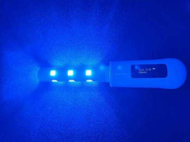 360° Гинекологично Неинвазивна Лазерна Терапия за Влагалищно Затягане