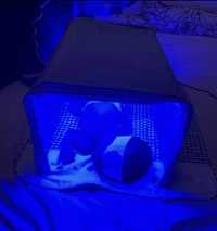 Фотолампа кювез для лечения желтушки новорожденных