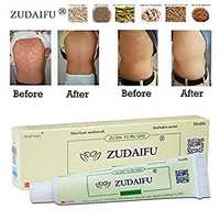 ZUDAIFU крем за псориазис, екзема, дерматит, гъбички и др.