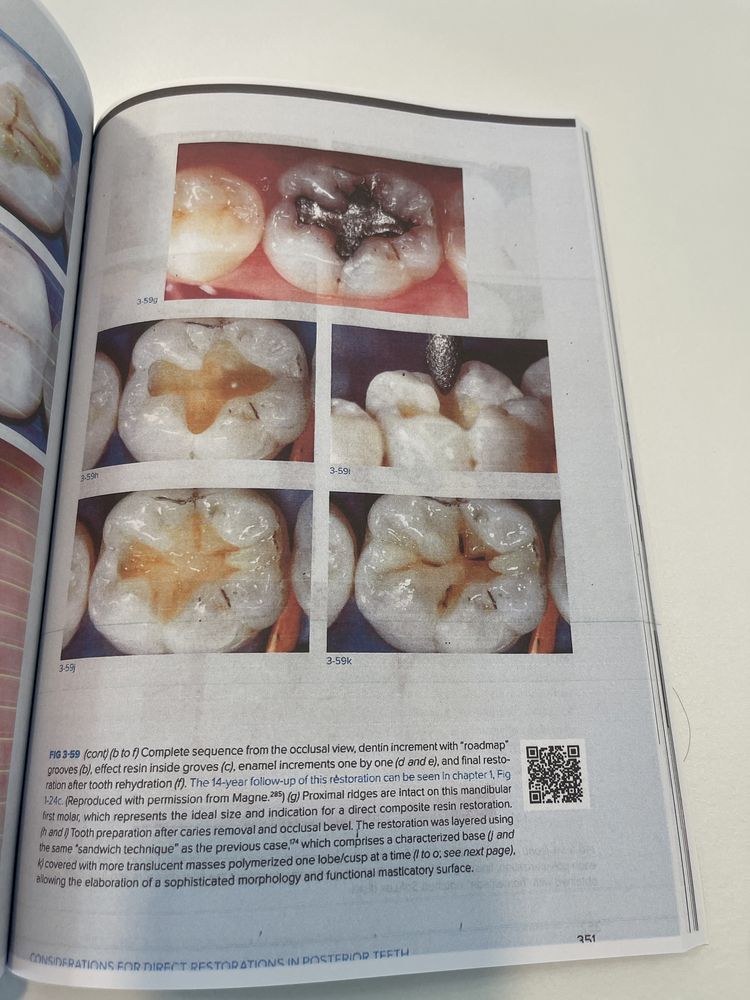 Biomimetic Restorative Dentistry  Volume 1 Pascal Magne Urs Belser