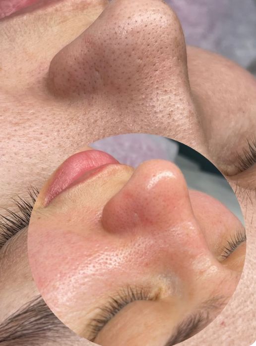 Требуются модели  на чистку лица мужчины женщины