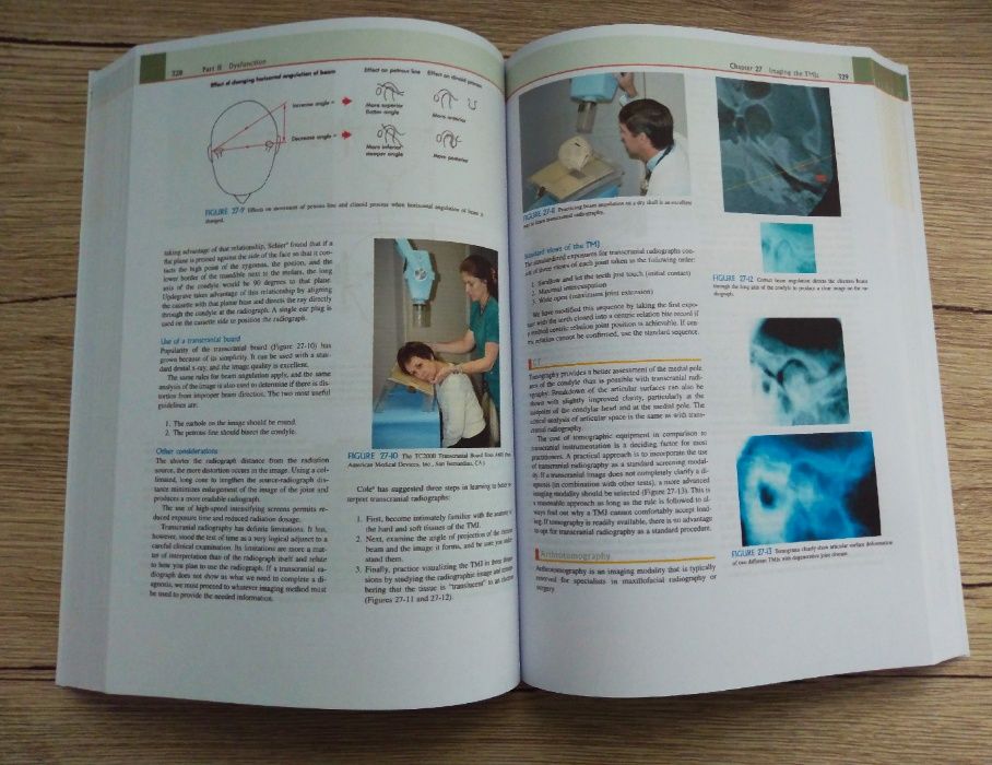 Functional Occlusion. From TMJ to Smile Design, Peter E. Dawson