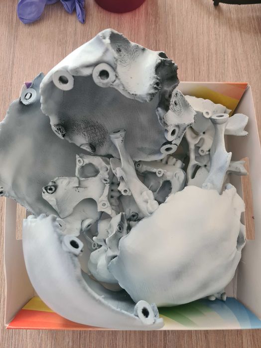 3D принтиран череп