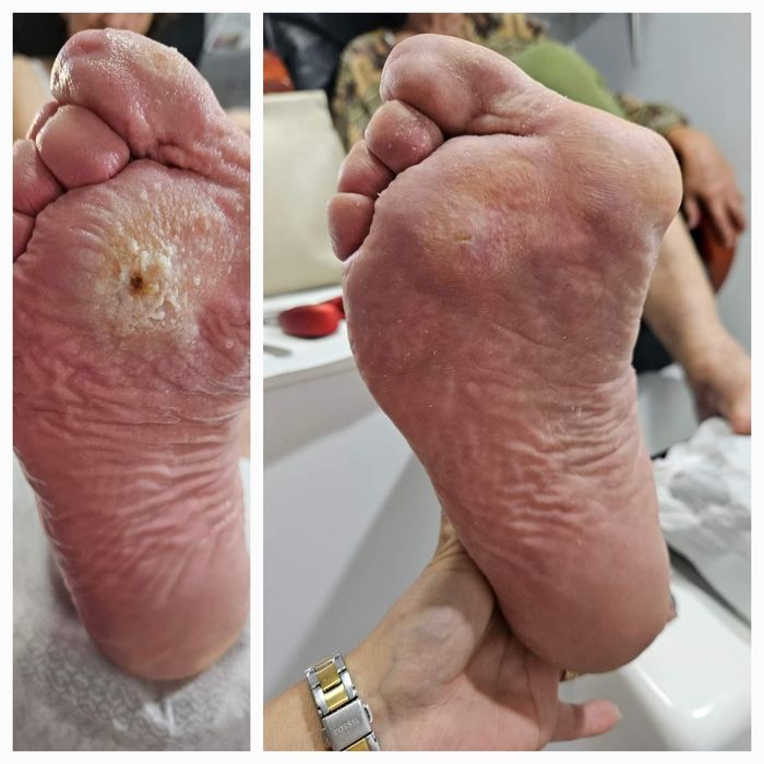 Pedichiură clasică Oradea