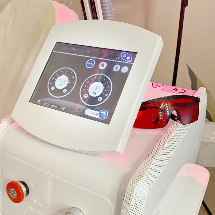 Laser NdYag indepartare tatuaj