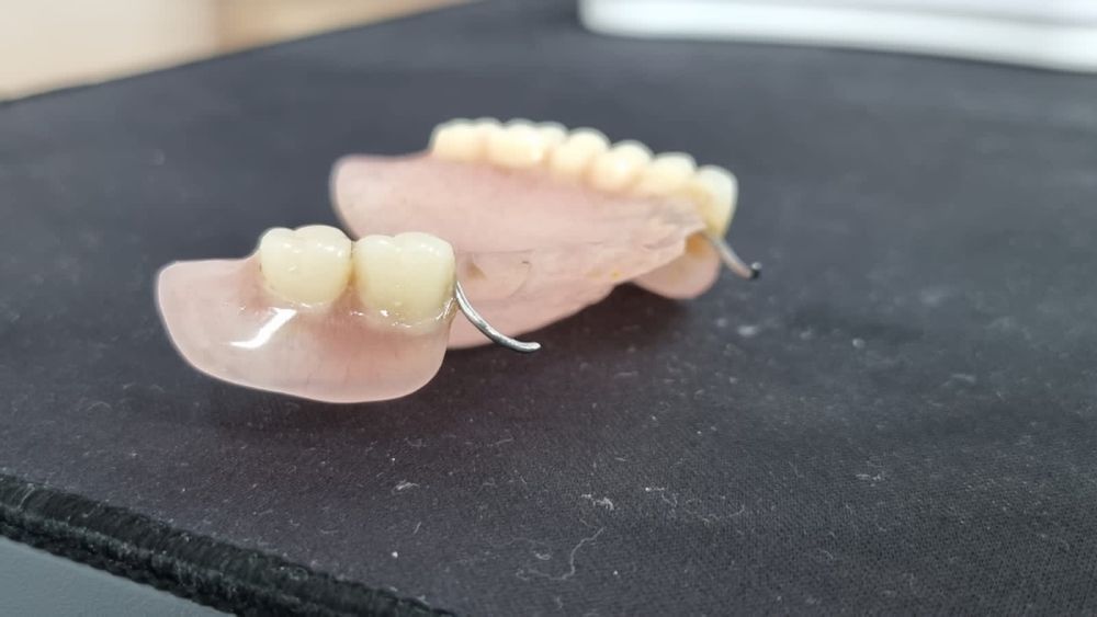 Починка протезов