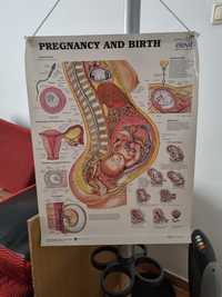Plansa Sarcina și Nașterea,  ginecologie