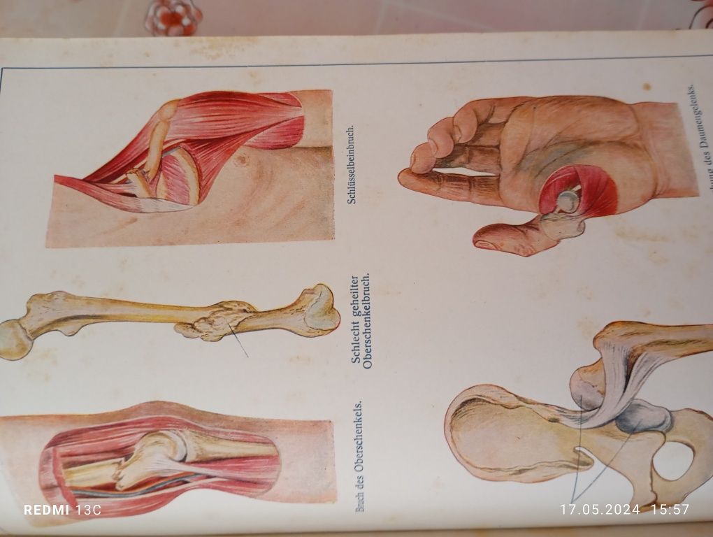 Carte medicală veche ilustrată în germană cu 960 pagini