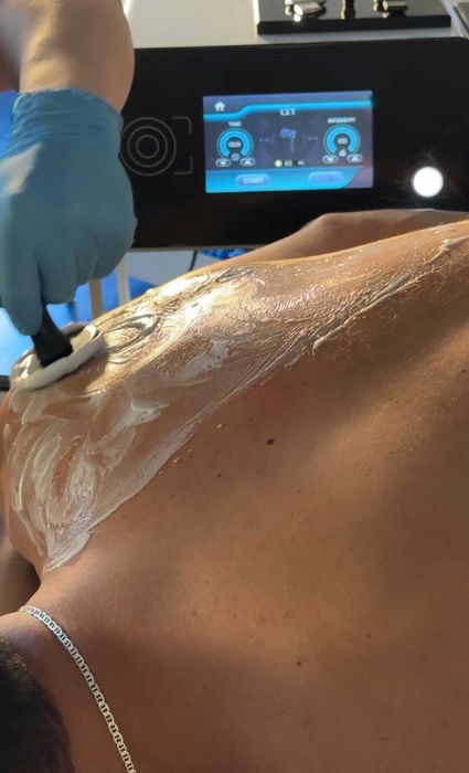 Kinetoterapie & Recuperare | Dry Needling, Tecar, Masaj Terapeutic