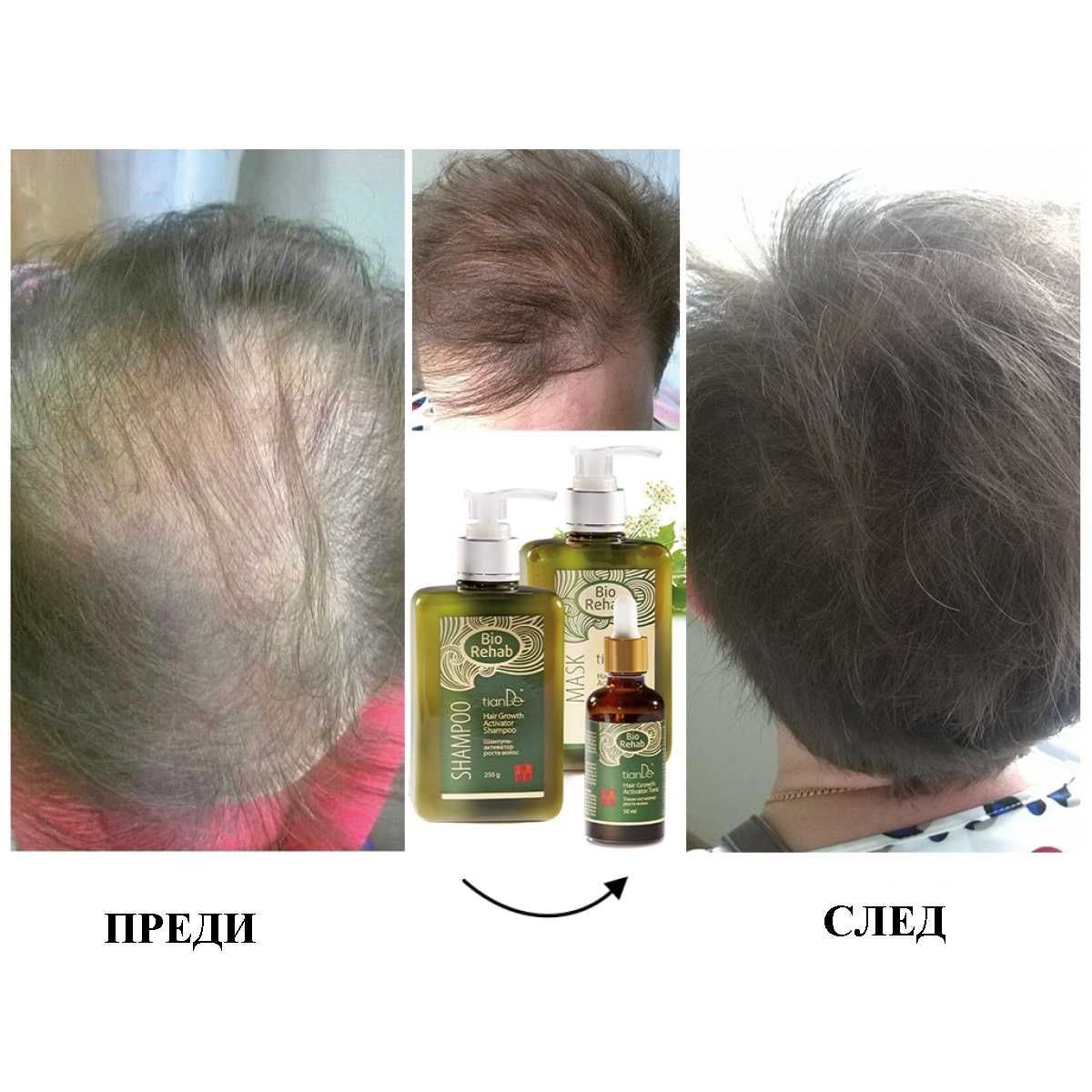 ТОП! Шампоан активатор на растежа„BIO REHAB“