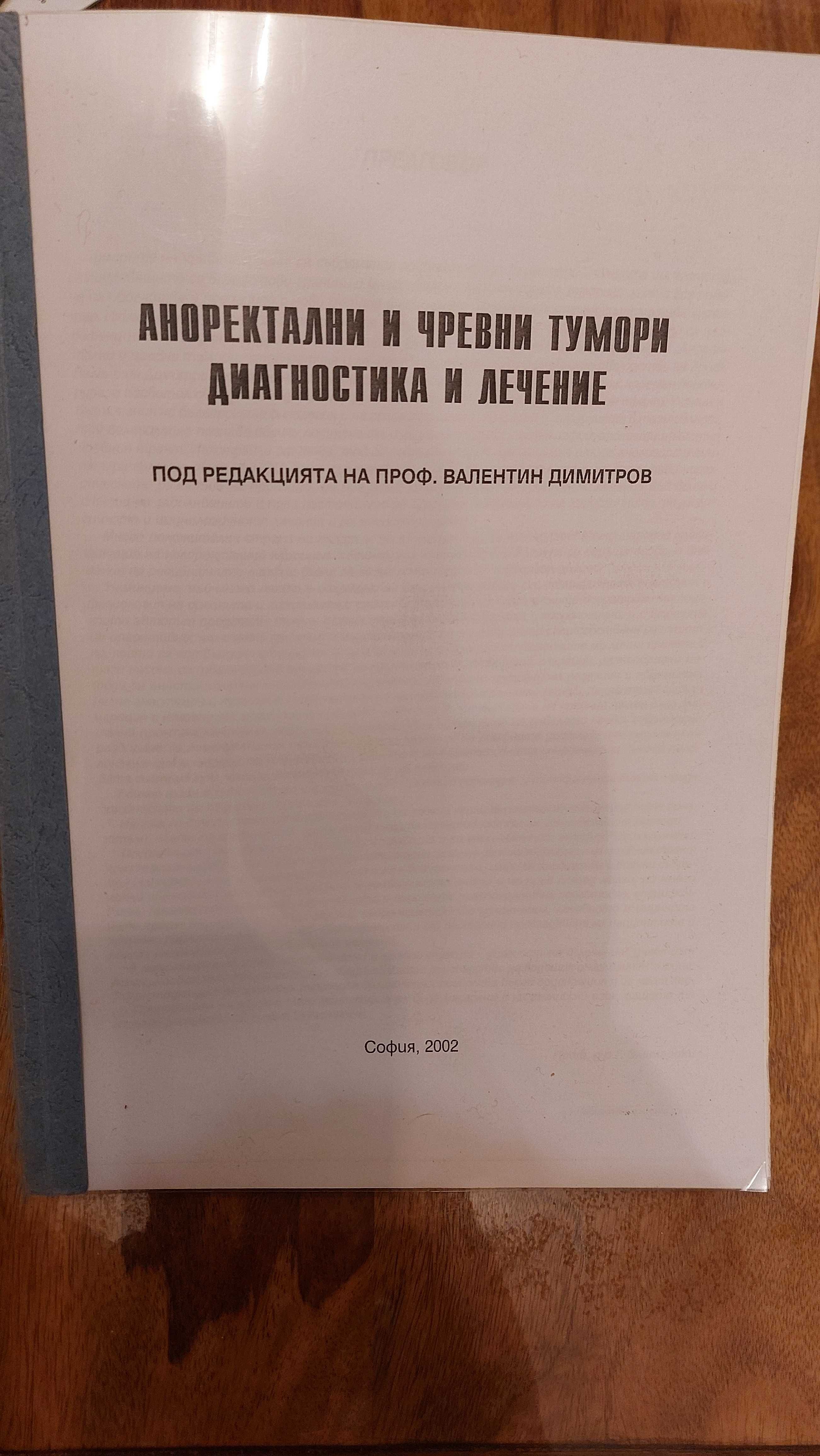 Аноректални и чревни тумори- диагностика и лечение