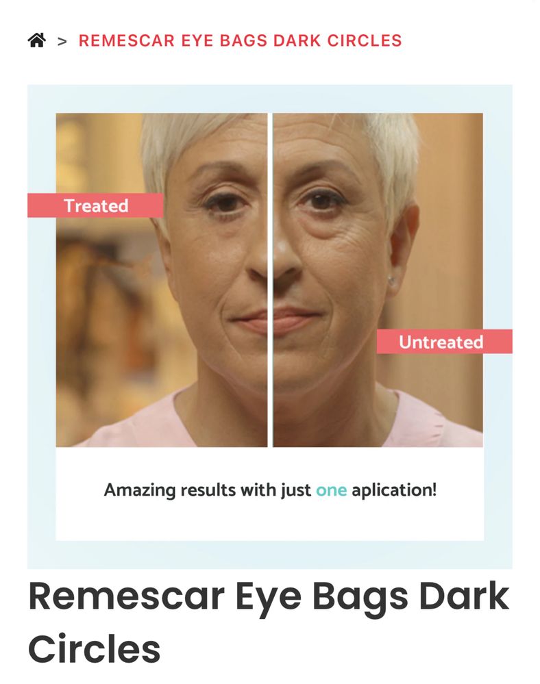 Remescar eyebags and dark circles anticearcan