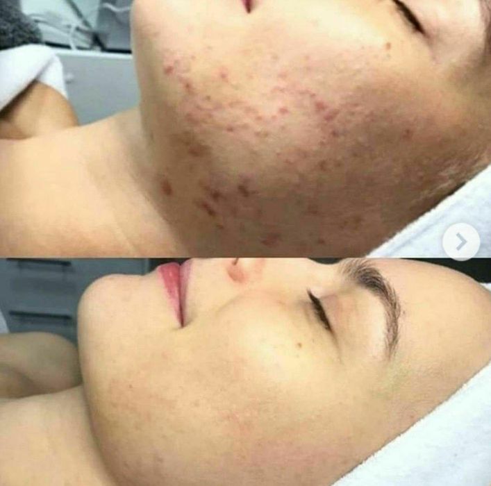 100% tabiy collagen ulitkalar sotuvda bor