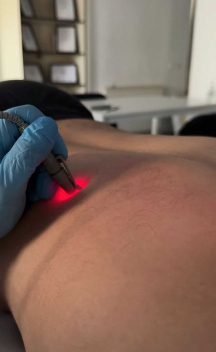 Kinetoterapie & Recuperare | Dry Needling, Tecar, Masaj Terapeutic