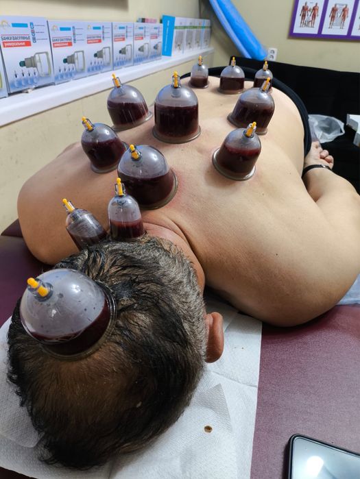 Хиджама , шертпе, ангина с выездом Алматы и Алматинская область