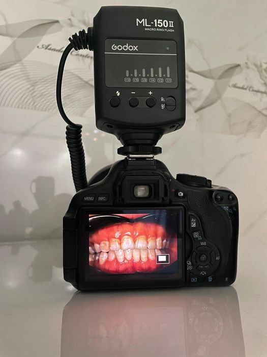Фотоаппарат для стоматолога