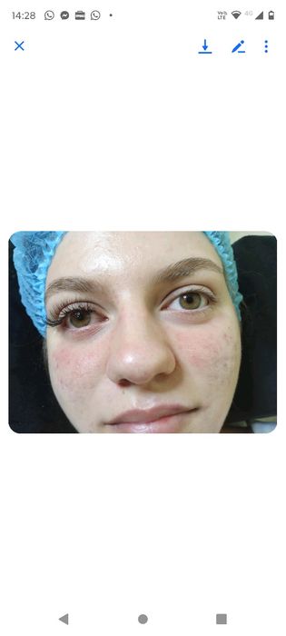 Extensii gene cu plata consumabilelor oferta