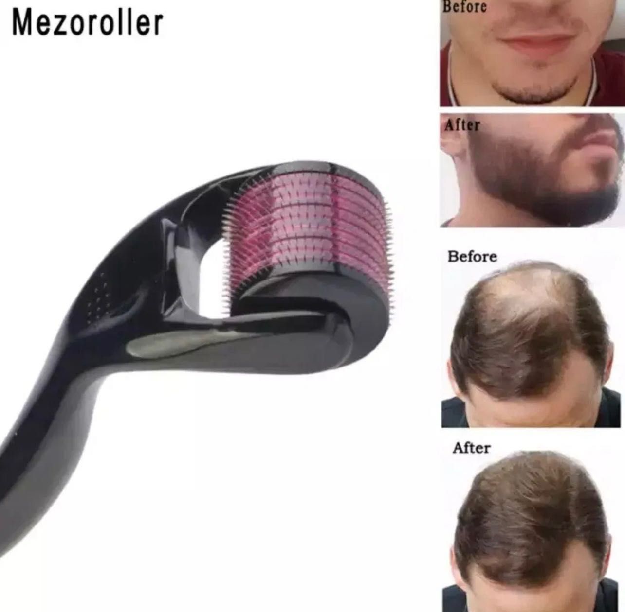 Beard oil. Beard growth. Soqol o’stirish dastafka bor