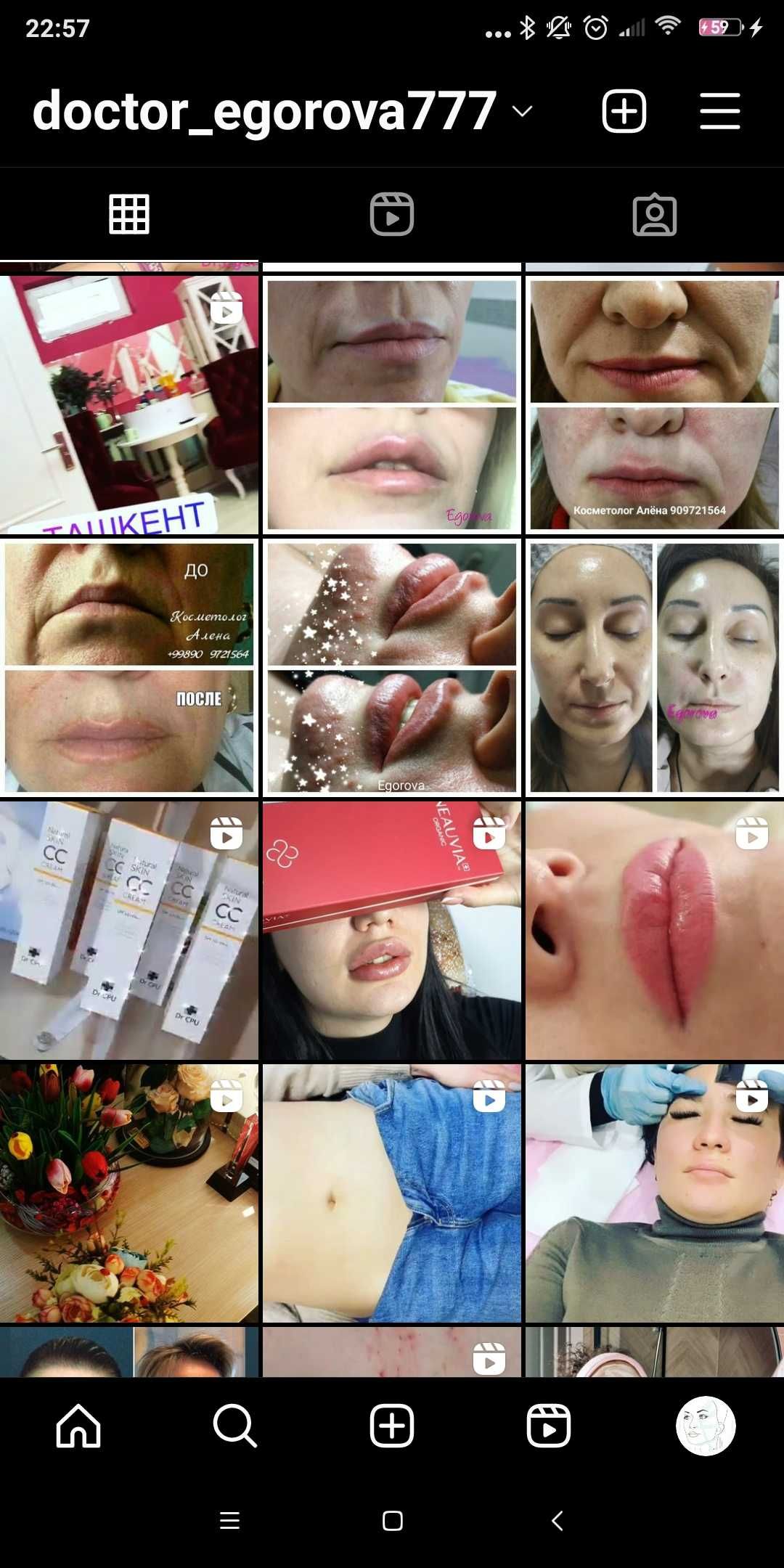 Акция на увеличение губ. Косметолог для женщин.