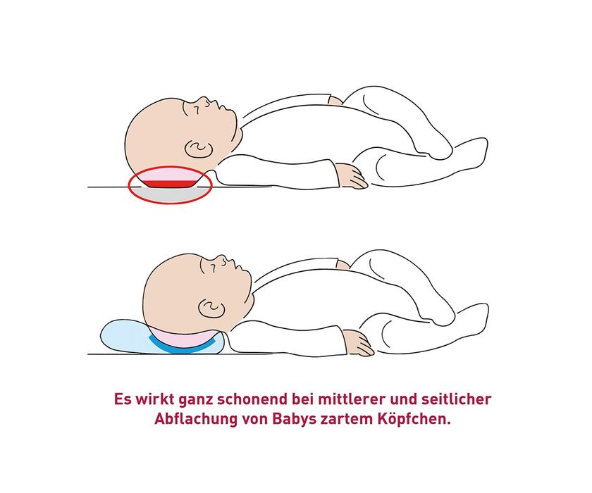 Ортопедична възглавница за новородено BabyDorm® ORIGINAL – медицинскот