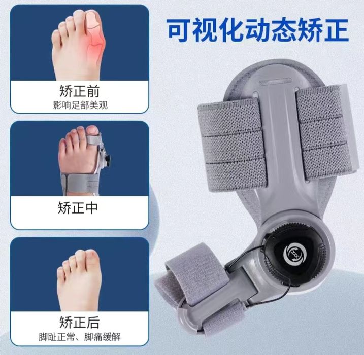 Сюяк усиб кийшайиши бор оек аппарати