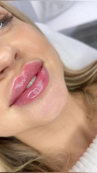 Lab shaklini to'g'rilash va kattalashtirish