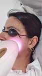 Epilare definitiva laser diode