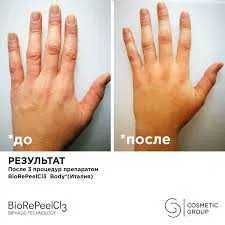 BioRePeel, срединный пилинг, 6мл (на 5-6 процедур). Италия оригинал!