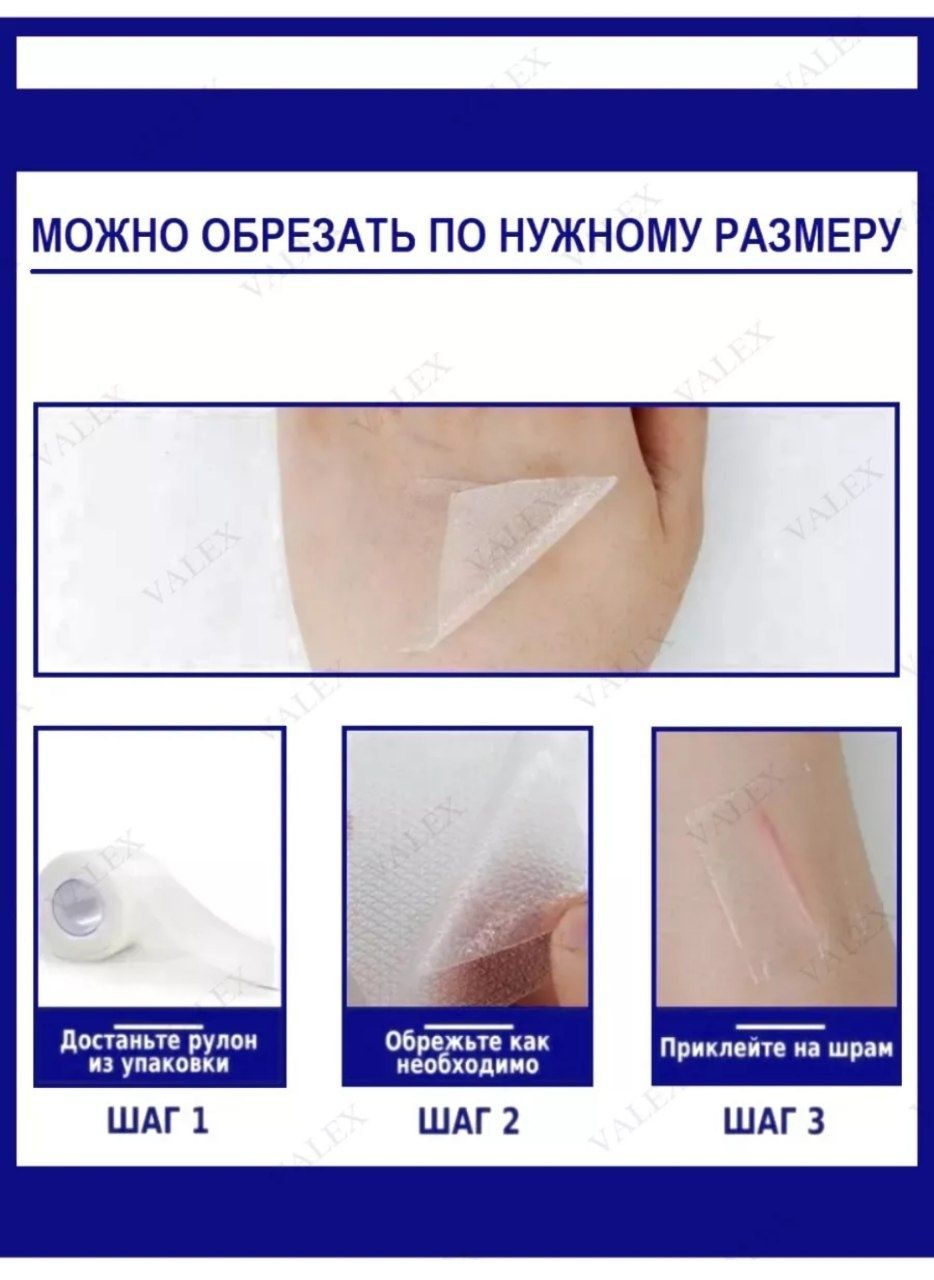 Продам силиконовый пластырь от рубцов
