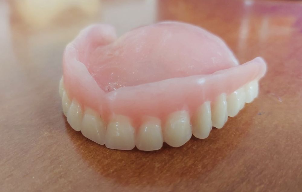 Proteze dentare acrilice. Reparatii si rebazari proteze dentare