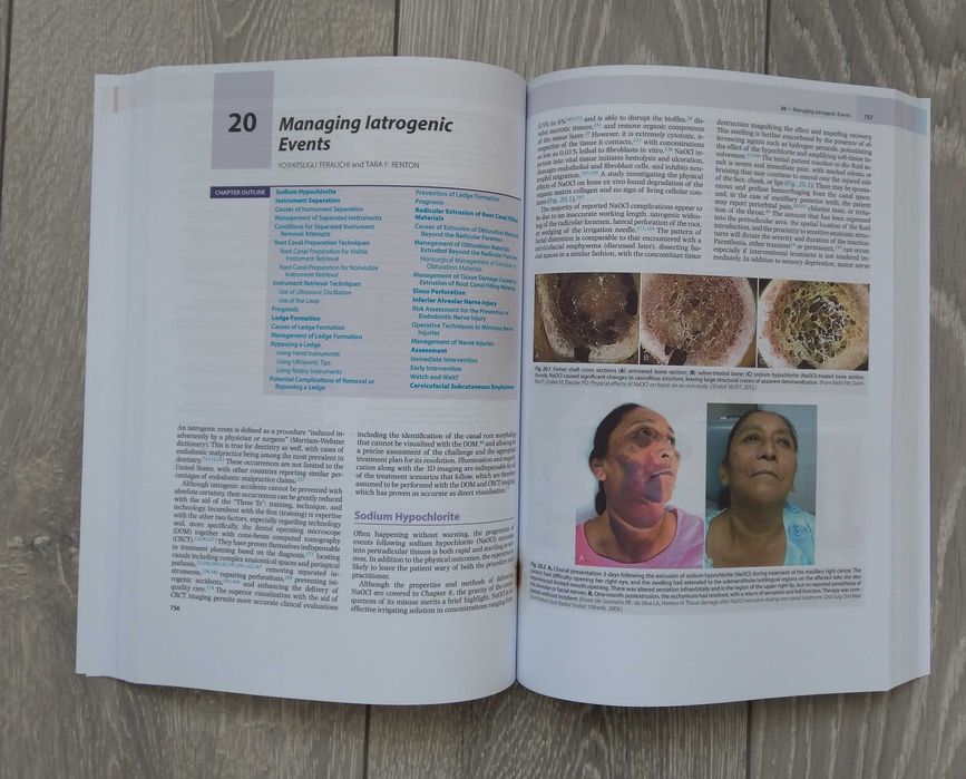 Cohen's Pathways of the Pulp: 12th Edition Engleza