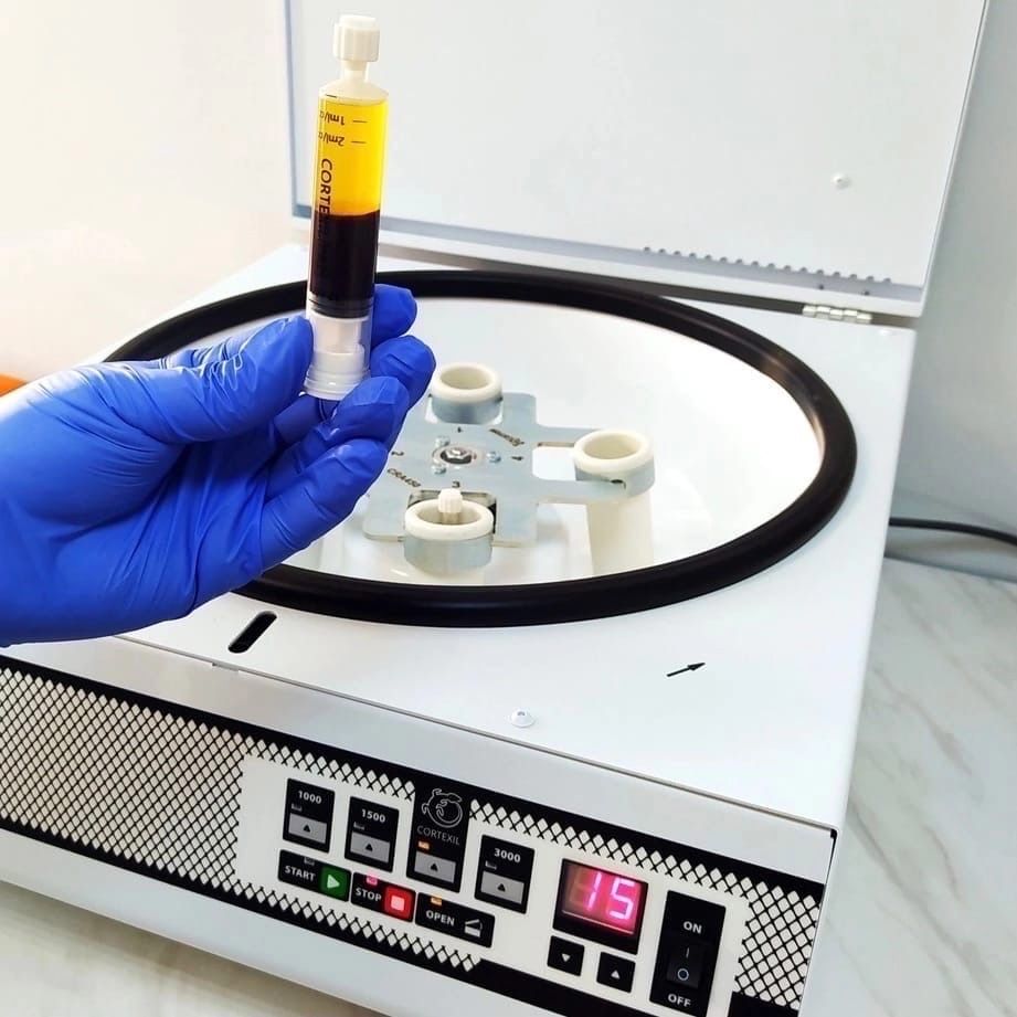 Cortexil PRP центрифуга аппарат для плазмолифтинга косметология