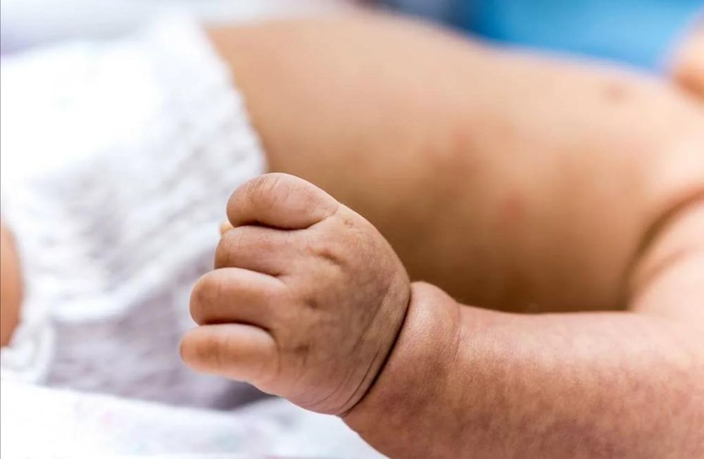 Детский массаж, гипоксия и т.д.