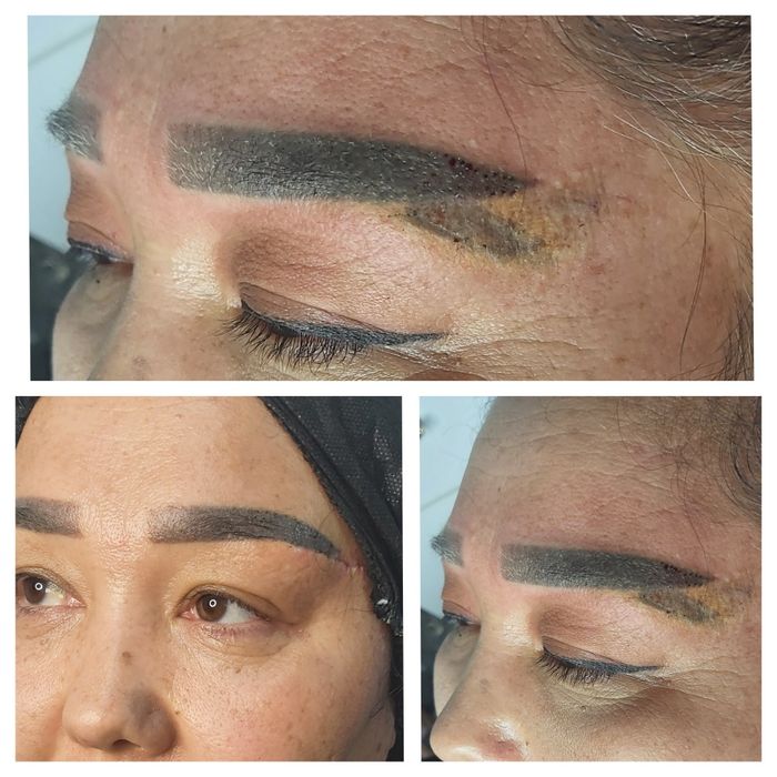 Лабиопластика,Броулифтинг,Блефаропластика.