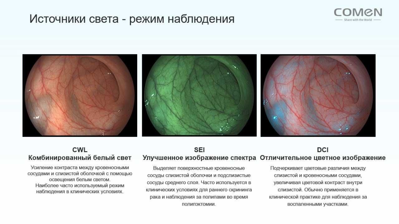Видеоэндоскопическая диагностическая система COMEN EIS 2000
