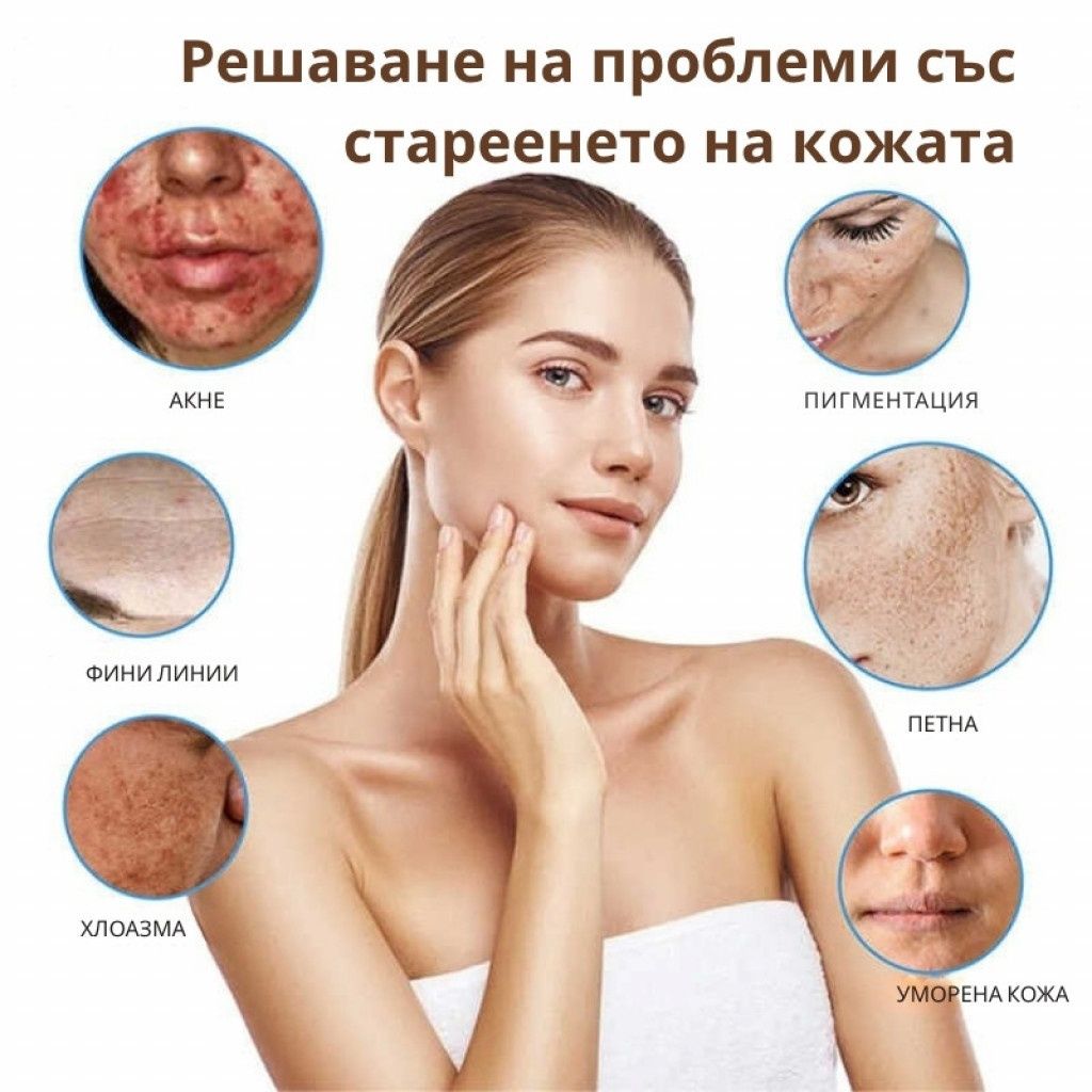 Крем за лице Mixia Rice Pretty Facial Cream - Избави се от акне, петна
