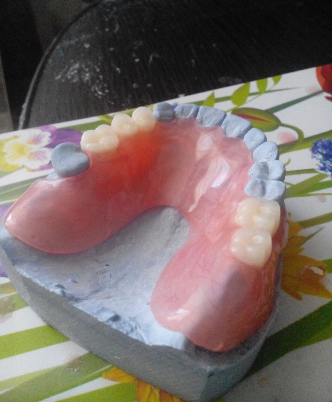 Зубные съёмные протезы